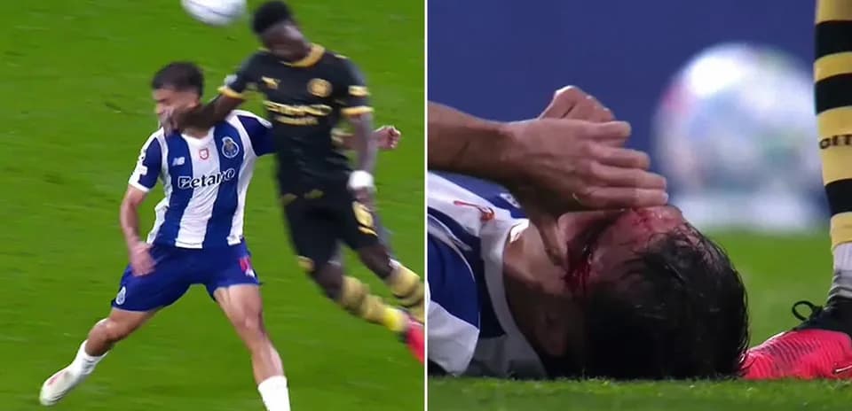 Jugador del Porto herido tras un choque en el partido