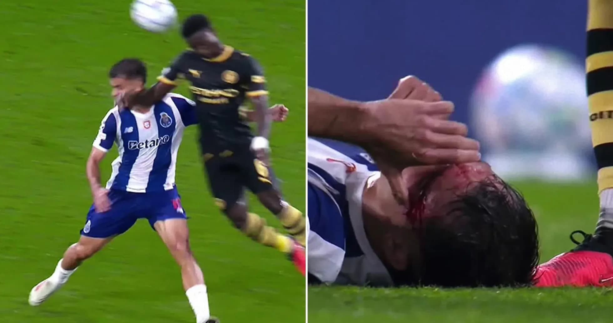 Jugador del Porto herido tras un choque en el partido Jugador del Porto herido tras un choque en el partido